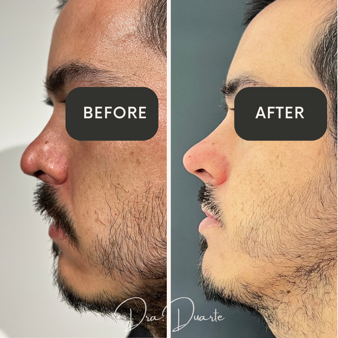 Embrague Bolso Clutch Hombre Γltimos Hombres De Cuero Tejido PU